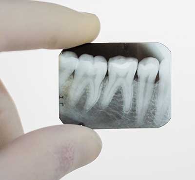 Dental Examination