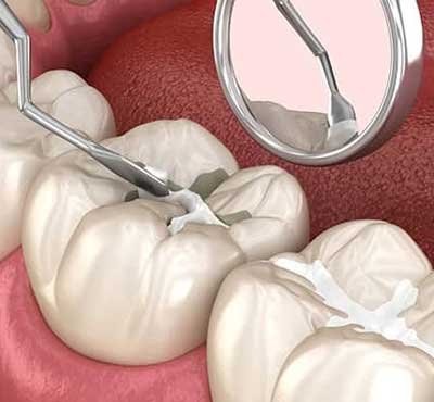 Dental Examination
