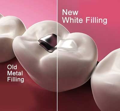 Dental Examination